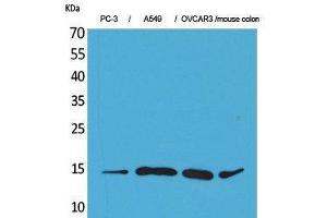Western Blotting (WB) image for anti-Chemokine (C-C Motif) Ligand 26 (CCL26) (Internal Region) antibody (ABIN3187694) (CCL26 anticorps  (Internal Region))