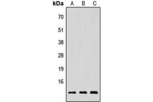 Western blot analysis of NRG4 expression in HEK293T (A), Raw264. (Neuregulin 4 anticorps  (Center))