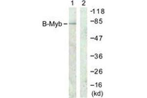 Western blot analysis of extracts from A549 cells, using B-Myb (Ab-577/581) Antibody. (MYBL2 anticorps  (AA 551-600))