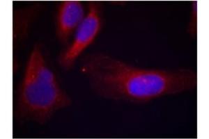 Image no. 1 for anti-Cas-Br-M (Murine) Ecotropic Retroviral Transforming Sequence (CBL) (pTyr700) antibody (ABIN319294) (CBL anticorps  (pTyr700))