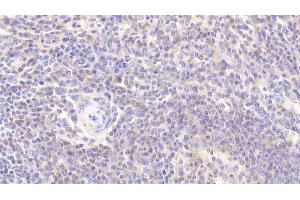 Detection of PARK7 in Human Spleen Tissue using Polyclonal Antibody to Parkinson Disease Protein 7 (PARK7) (PARK7/DJ1 anticorps  (AA 1-189))
