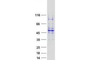 Validation with Western Blot