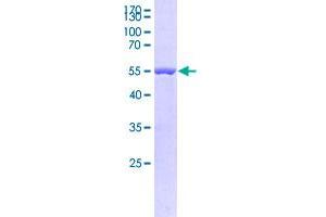 Image no. 1 for ChaC, Cation Transport Regulator Homolog 1 (CHAC1) (AA 1-222) protein (GST tag) (ABIN4369905)