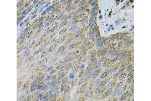 Immunohistochemistry of paraffin-embedded Human esophagus using AK1 Polyclonal Antibody at dilution of 1:100 (40x lens). (Adenylate Kinase 1 anticorps)