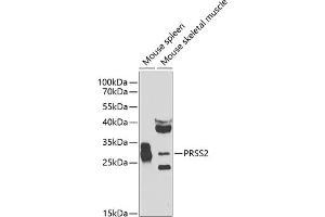 Western blot analysis of extracts of various cell lines, using PRSS2 antibody (ABIN6131363, ABIN6146279, ABIN6146280 and ABIN6223919) at 1:1000 dilution. (PRSS2 anticorps  (AA 24-247))
