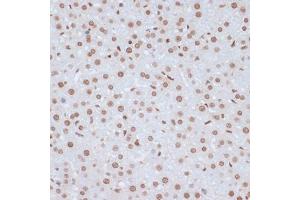 Immunohistochemistry of paraffin-embedded rat liver using Phospho-ERK1-Y204 antibody (ABIN3019889, ABIN3019890, ABIN3019891 and ABIN1681795) at dilution of 1:100 (40x lens). (ERK1 anticorps  (pTyr204))