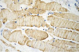 Immunohistochemistry was performed on paraffin-embedded mouse skeletal muscle using desmin antibody (ABIN7798314), 1:200). (Recombinant Desmin anticorps)