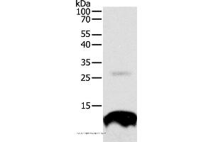 Western blot analysis of 293T cell, using TNFRSF12A Polyclonal Antibody at dilution of 1:300 (TNFRSF12A anticorps)