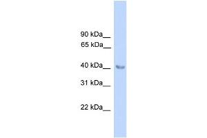 WB Suggested Anti-ALAD Antibody Titration:  0. (ALAD anticorps  (N-Term))