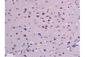 Formalin-fixed and paraffin embedded rat brain labeled with Anti-Beta-Catenin (Ser33 + 37) Polyclonal Antibody, Unconjugated  at 1:200 followed by conjugation to the secondary antibody and DAB staining.