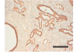 Image no. 1 for anti-Keratin Acidic (AE1) antibody (ABIN341106) (Keratin Acidic (AE1) anticorps)