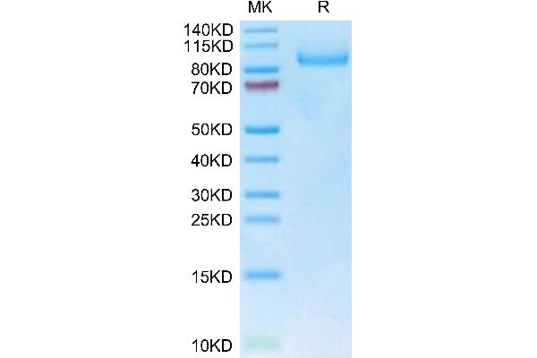 Neuropilin 1 Protein (NRP1) (AA 22-644) (His tag)