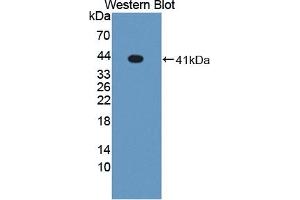 Detection of recombinant LXRa using Polyclonal Antibody to Liver X Receptor Alpha (LXRa) (NR1H3 anticorps  (AA 95-434))