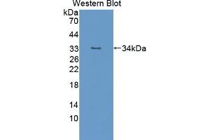Detection of Recombinant TTK, Mouse using Polyclonal Antibody to TTK Protein Kinase (TTK)