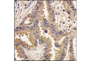 Image no. 1 for anti-BCL2-Associated Agonist of Cell Death (BAD) (Middle Region) antibody (ABIN356826) (BAD anticorps  (Middle Region))