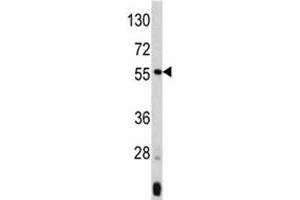 Western blot analysis of ANGPTL3 antibody and mouse liver tissue lysate. (ANGPTL3 anticorps  (AA 82-114))