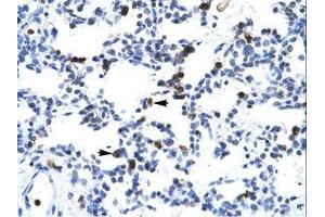 anti-E2F Transcription Factor 6 (E2F6) (AA 43-92) antibody