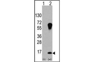 Western blot analysis of LC3 (APG8a) (arrow) using LC3 Antibody . (MAP1LC3A anticorps)