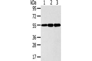 Gel: 8 % SDS-PAGE,Lysate: 40 μg,Lane 1-3: 293T cells, LO2 cells, Lovo cells,Primary antibody: ABIN7191125(ISM2 Antibody) at dilution 1/300 dilution,Secondary antibody: Goat anti rabbit IgG at 1/8000 dilution,Exposure time: 5 seconds