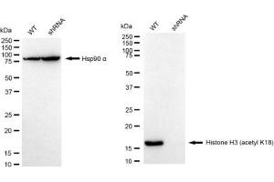 Western blotting analysis using Histone H3 (acetyl K18) antibody (ABIN7798970).