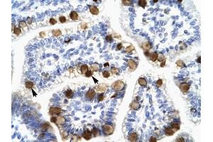 YWHAH antibody was used for immunohistochemistry at a concentration of 4-8 ug/ml to stain Epithelial cells of intestinal villus (arrows) in Human Intestine.