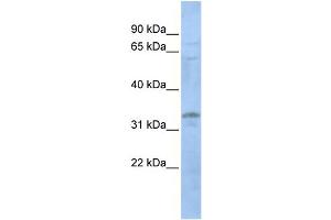 WB Suggested Anti-LYL1  Antibody Titration: 0.