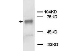 Western Blot analysis of PTPN11 expression from Jurkat cell lyate with PTPN11 polyclonal antibody . (PTPN11 anticorps  (C-Term))