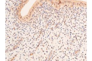 ABIN6267066 at 1/200 staining rat uterine tissue sections by IHC-P. (p53 anticorps  (acLys319))
