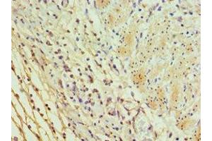 Immunohistochemistry of paraffin-embedded human epityphlon tissue using ABIN7156037 at dilution of 1:100 (ICOSLG anticorps  (AA 19-256))