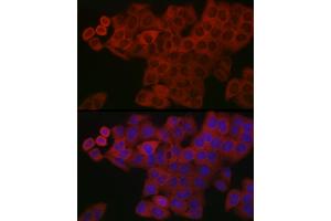 Immunofluorescence analysis of HeLa cells using PDGFB Rabbit pAb (ABIN3021688, ABIN3021689, ABIN3021690 and ABIN6215511) at dilution of 1:150 (40x lens).