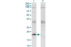 Western Blot analysis of LMO2 expression in transfected 293T cell line by LMO2 monoclonal antibody (M07), clone 4E2. (LMO2 anticorps  (AA 16-102))