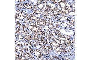 IHC analysis of TRMT61A using anti-TRMT61A antibody (ABIN7599220). (TRMT61A anticorps  (AA 1-289))