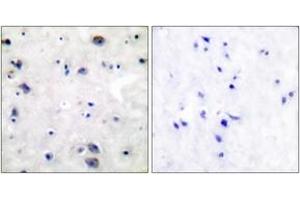Immunohistochemistry (IHC) image for anti-Opioid Receptor, mu 1 (OPRM1) (AA 341-390) antibody (ABIN2888574) (Mu Opioid Receptor 1 anticorps  (AA 341-390))