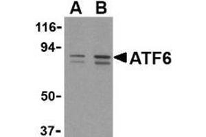 Western blot analysis of ATF6 in MCF7 cell lysate with this product atF6 antibody at (A) 0. (ATF6 anticorps  (C-Term))
