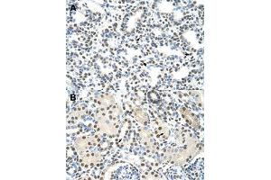 Immunohistochemical staining (Formalin-fixed paraffin-embedded sections) of human lung (A) and human kidney (B) with AKAP8L polyclonal antibody  at 4-8 ug/mL working concentration. (AKAP8L anticorps  (C-Term))