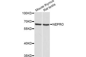 Western blot analysis of extracts of various cell lines, using NEPRO Antibody (ABIN5998324) at 1/1000 dilution. (NEPRO anticorps)