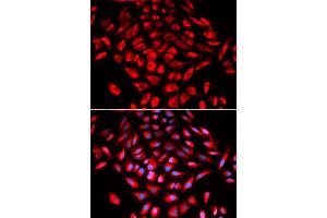 Immunofluorescence analysis of U2OS cells using CAMK4 antibody (ABIN5973050). (CAMK4 anticorps)