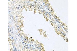 Immunohistochemistry of paraffin-embedded Human prostate using PPP3R1 Polyclonal Antibody at dilution of 1:100 (40x lens). (PPP3R1 anticorps)