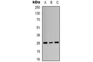 Western blot analysis of 14-3-3 zeta (pT232) expression in A431 UV-treated (A), K562 UV-treated (B), NIH3T3 UV-treated (C) whole cell lysates. (14-3-3 zeta anticorps  (C-Term, pThr232))