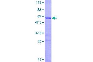 Image no. 1 for Homeobox B9 (HOXB9) (AA 1-250) protein (GST tag) (ABIN1306967)