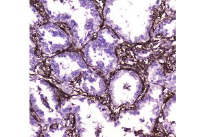 IHC analysis of Annexin VI using anti-Annexin VI antibody .