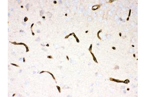 Anti- Dystrophin Picoband antibody, IHC(P) IHC(P): Mouse Brain Tissue