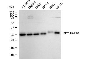 anti-B-Cell CLL/lymphoma 10 (BCL10) antibody