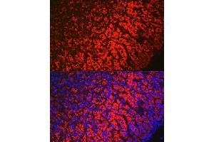 Immunofluorescence analysis of mouse adrenal gland using HSD3B1 Rabbit pAb (ABIN6131041, ABIN6142016, ABIN6142017 and ABIN6224059) at dilution of 1:100 (40x lens). (HSD3B1 anticorps  (AA 1-290))