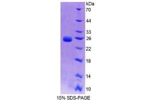 SDS-PAGE analysis of Rat BCAT2 Protein. (BCAT2 Protéine)
