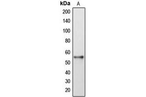 Western blot analysis of DFNA5 expression in HeLa (A) whole cell lysates. (DFNA5 anticorps  (Center))