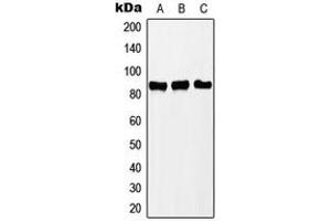 Western blot analysis of PNPT1 expression in Jurkat (A), MCF7 (B), HeLa (C) whole cell lysates. (PNPT1 anticorps  (C-Term))