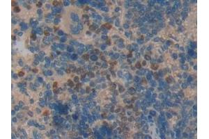 Detection of CCL6 in Rat Spleen Tissue using Polyclonal Antibody to Chemokine (C-C motif) ligand 6 (CCL6)