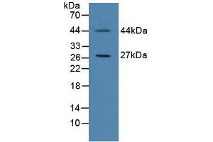 Detection of CIDEC in Human Hela Cells using Polyclonal Antibody to Cell Death Inducing DFFA Like Effector C (CIDEC)