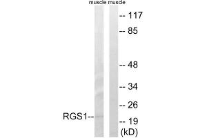 Western blot analysis of extracts from mouse muscle cells, using RGS1 antibody. (RGS1 anticorps  (Internal Region))